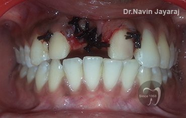 tmj pain centre kerala