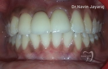 tmj pain centre kerala