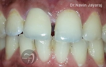 tmj pain centre kerala