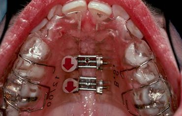 tmd symptoms finding centre kerala