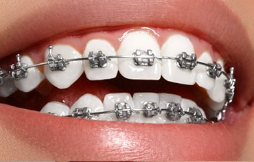 tmj disorder treatments kerala