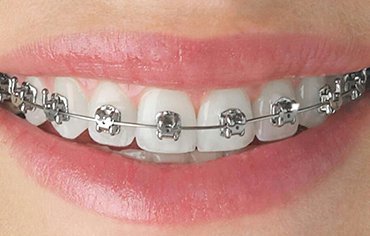 treatment for maigrane