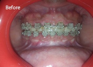 Snoring Treatments manjeri