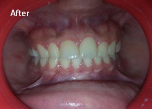 disturbed sleep treatments manjeri