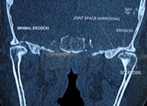 good Snoring Treatments vadakara