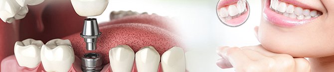 headache and maigraine centre manjeri